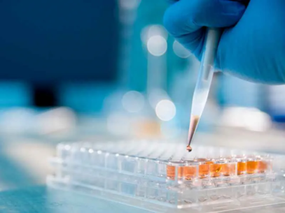 A scientist deposits a liquid onto a multi-well plate using a pipette.
